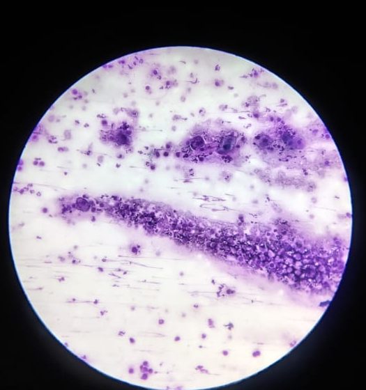 Muestra de laboratorio vista al microscopio